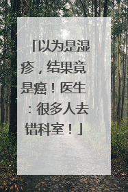 以为是湿疹，结果竟是癌！医生：很多人去错科室！